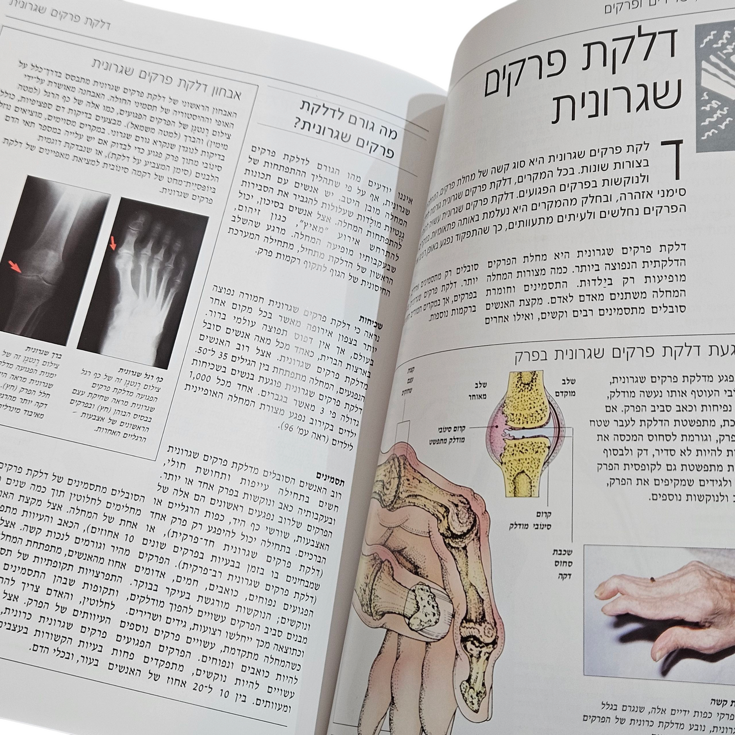 האינציקלופדיה הרפואית החדשה - שרירים, עצמות ופרקים
