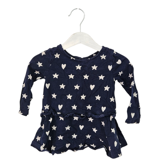 GAP שמלה לילדות גיל 12-18 חודשים